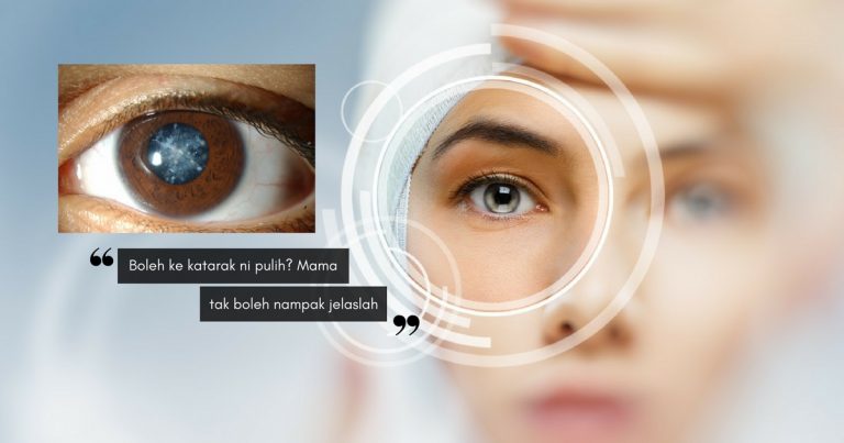 Pandangan Nampak Berkabut? Awas Tanda Putih Ini Dalam Mata, Anda Mungkin Menghidap KATARAK