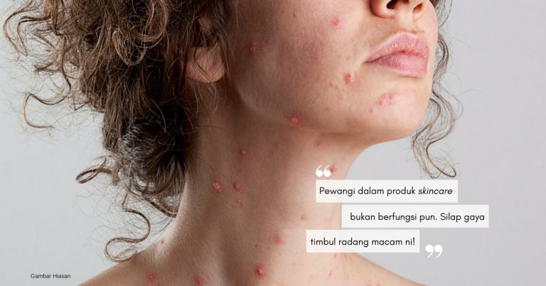 Harumnya Aroma Produk Ni, Tapi Tunggu…. Ach-ummmm! Nah, Jaga-Jaga Wangian Juga Sensitif Pada Kulit