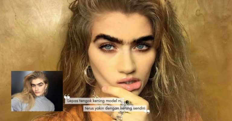 Bangga Berkening Tebal & Bercantum Di Tengah, Model Ini Berani Keluar Daripada STANDARD KECANTIKAN Dunia