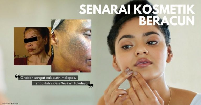 7 Senarai Terkini Kosmetik Beracun Yang Mengandungi TRETINOIN, HYDROQUINONE & MERKURI Di Malaysia