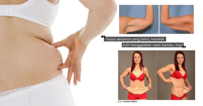 Badan Dah Kurus Tapi Kulit Pula FLABBY, Lakukan 20 Cara Efektif Ini Untuk Mengencangkan Kulit Kendur