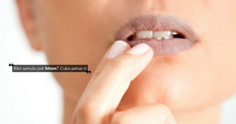 10 Petua MENCERAHKAN BIBIR Yang Gelap, Berguna Sangat Kalau Pernah Merokok!