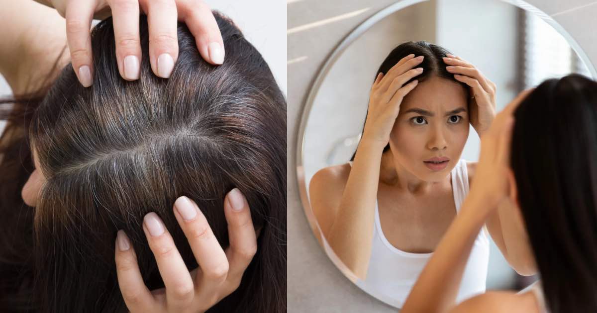 Usia 30-an Dah Beruban? Semak Punca, Diet & Cara-Cara Atasi Uban Dari Awal