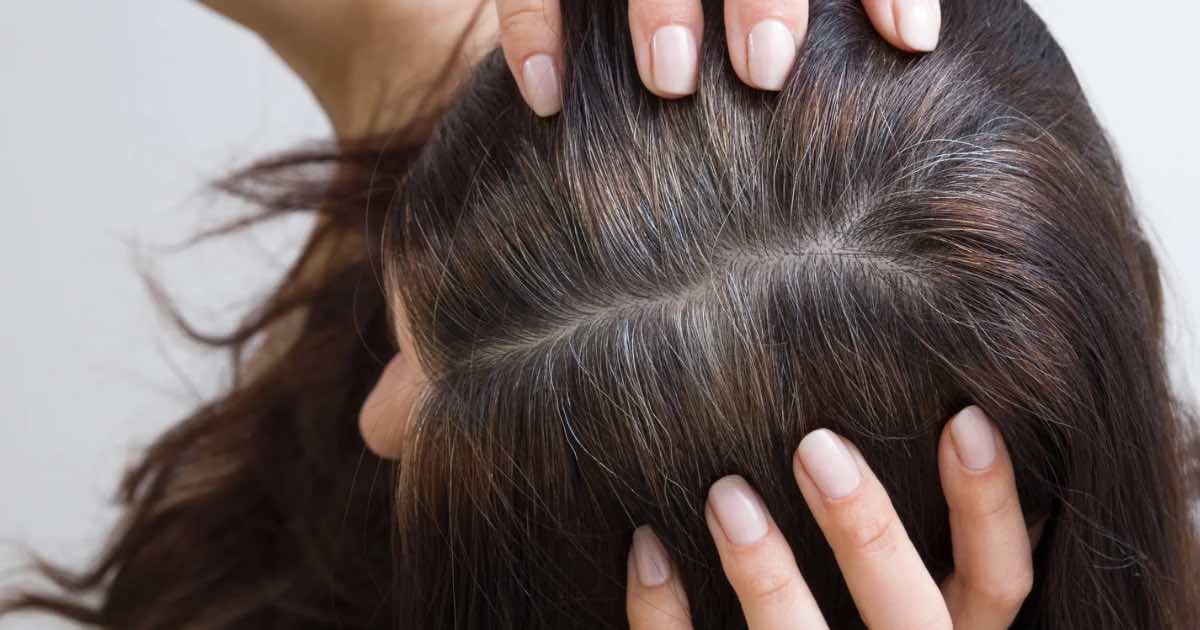 Usia 30-an Dah Beruban? Semak Punca, Diet & Cara-Cara Atasi Uban Dari Awal