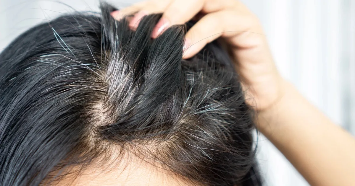 Usia 30-an Dah Beruban? Semak Punca, Diet & Cara-Cara Atasi Uban Dari Awal