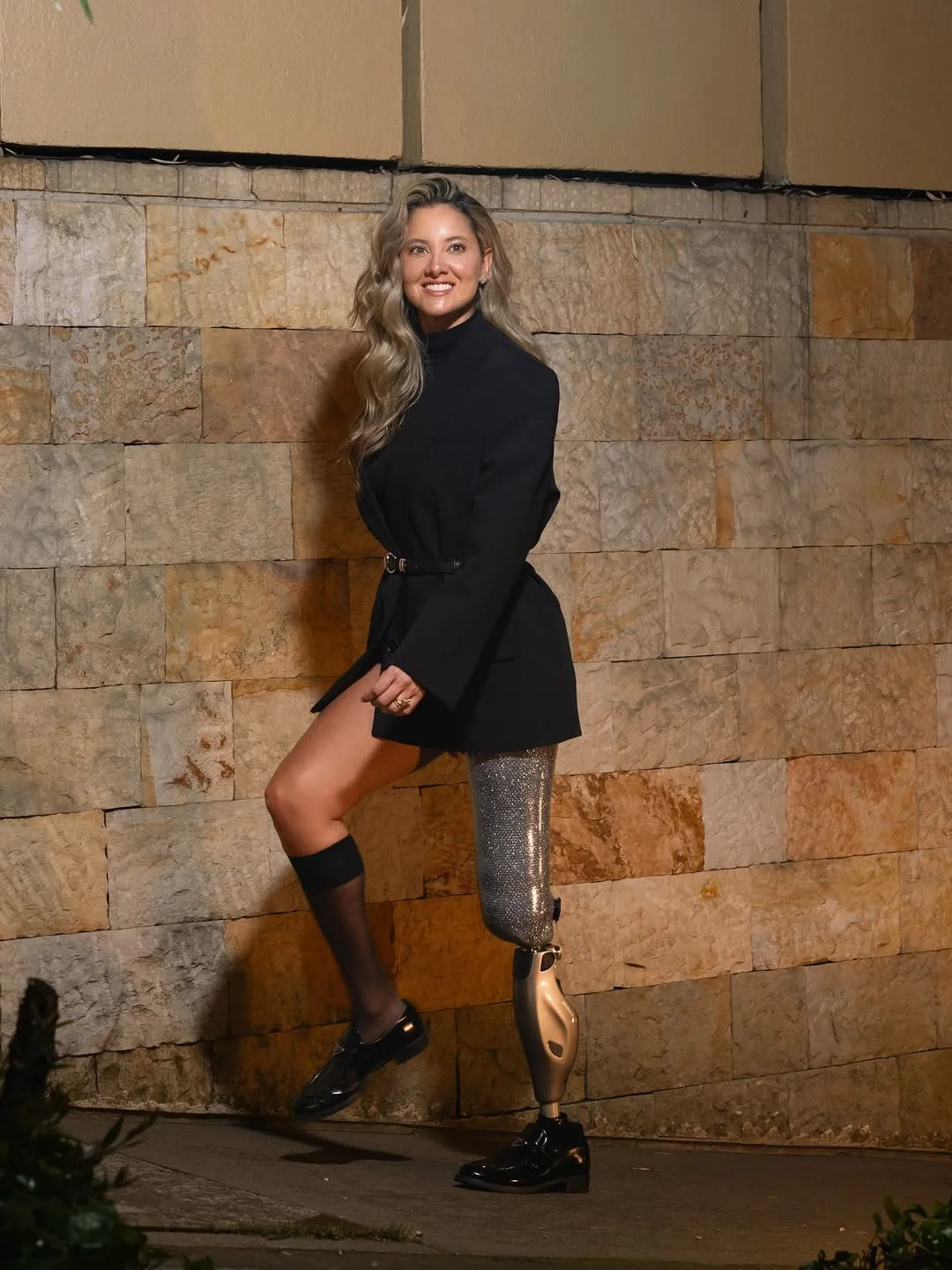 Tetap Yakin & Ceria Meski Hilang Sebelah Kaki, Perjuangan Bekas Ratu Cantik Sejak 5 Tahun Lalu Suntik Semangat!