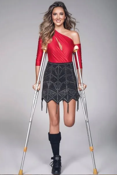 Tetap Yakin & Ceria Meski Hilang Sebelah Kaki, Perjuangan Bekas Ratu Cantik Sejak 5 Tahun Lalu Suntik Semangat! 20 Tetap Yakin & Ceria Meski Hilang Sebelah Kaki, Perjuangan Bekas Ratu Cantik Sejak 5 Tahun Lalu Suntik Semangat!