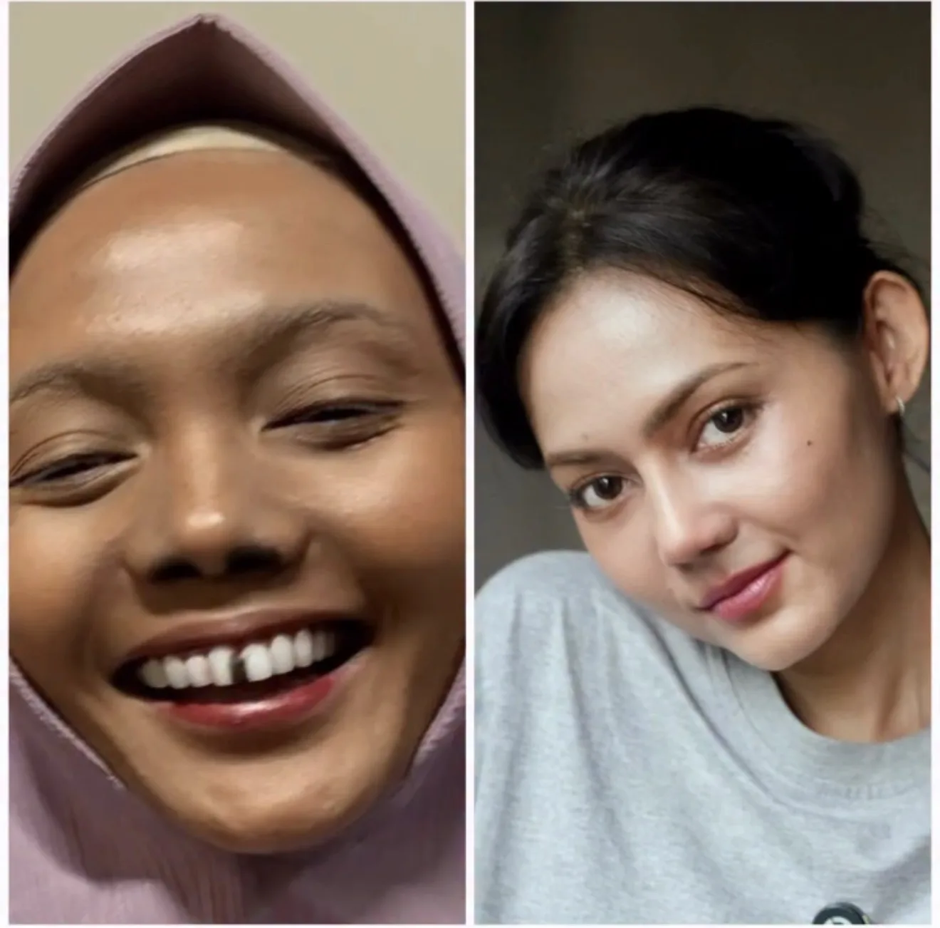 Rina Nose Pamer Wajah Selepas Jalani Pembedahan Plastik, Ubah ‘Trade Mark’ Hidung Demi Psikologi Sihat