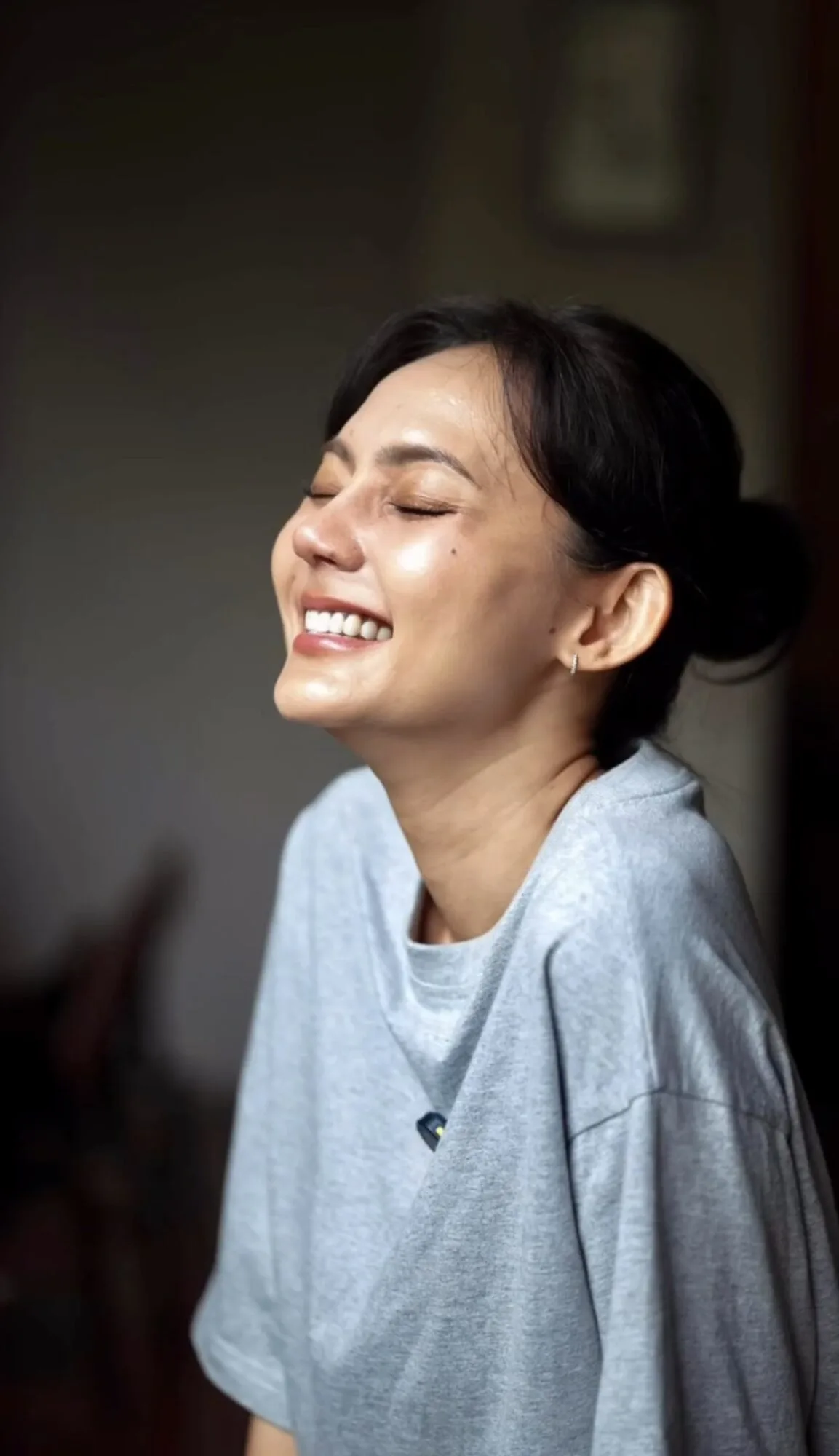 Rina Nose Pamer Wajah Selepas Jalani Pembedahan Plastik, Ubah ‘Trade Mark’ Hidung Demi Psikologi Sihat