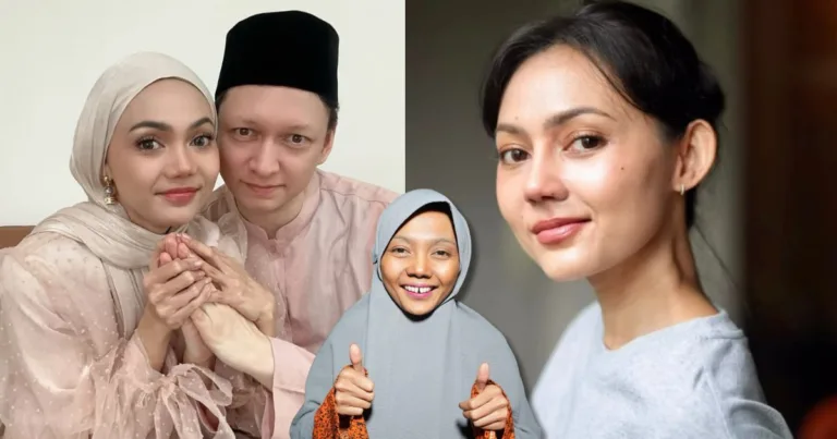 Rina Nose Pamer Wajah Selepas Jalani Pembedahan Plastik, Ubah ‘Trade Mark’ Hidung Demi Psikologi Sihat