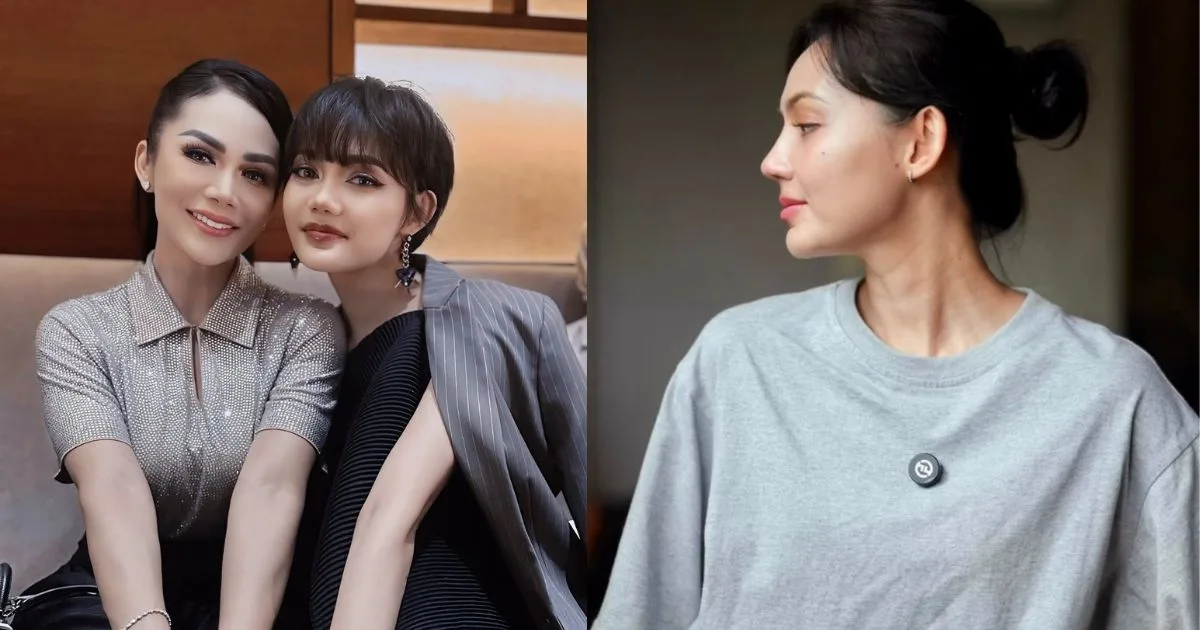 Rina Nose Pamer Wajah Selepas Jalani Pembedahan Plastik, Ubah ‘Trade Mark’ Hidung Demi Psikologi Sihat